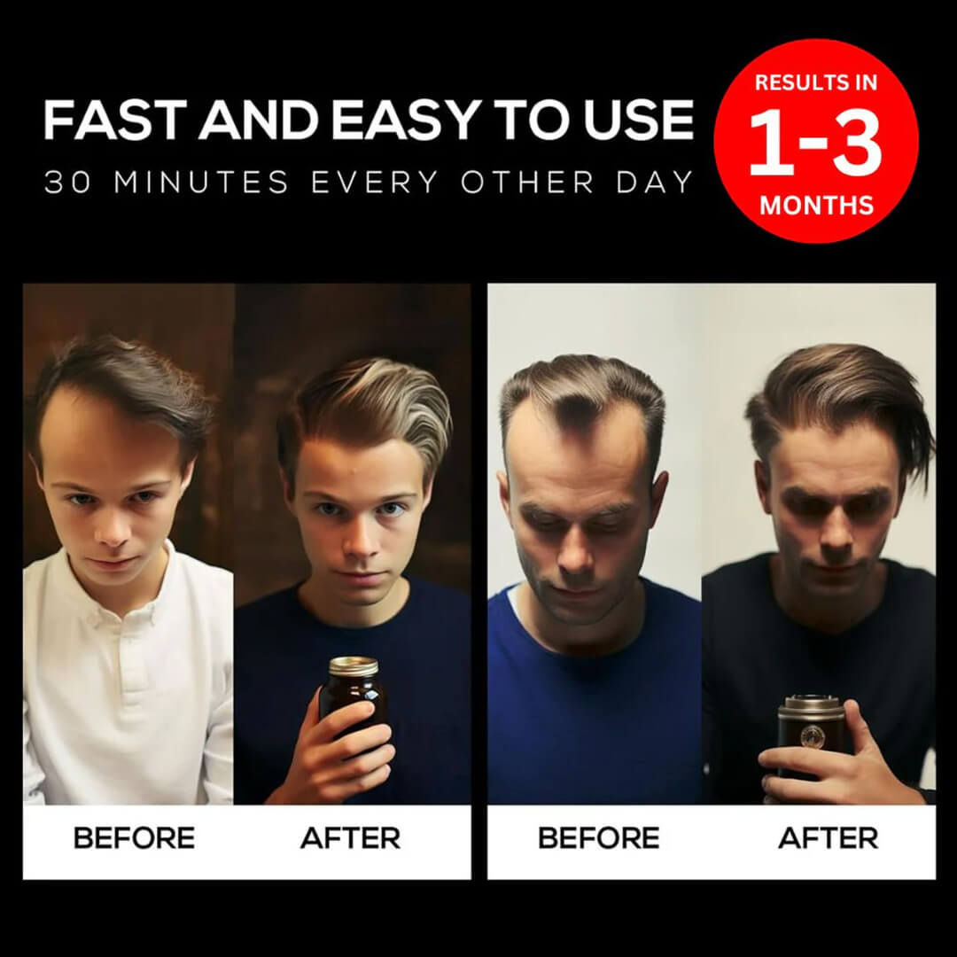 FolliCure™ – Laser Hair Regrowth Cap for Men