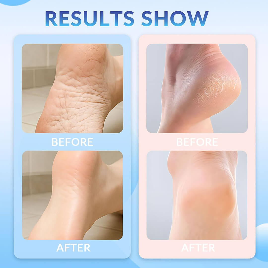 StrideGuard™ Stick