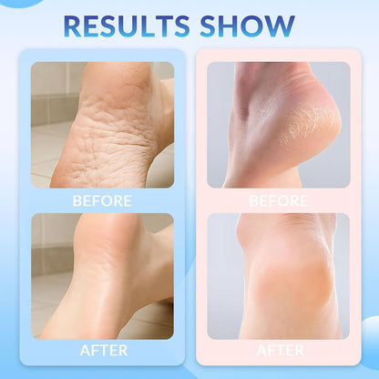 StrideGuard™ Stick