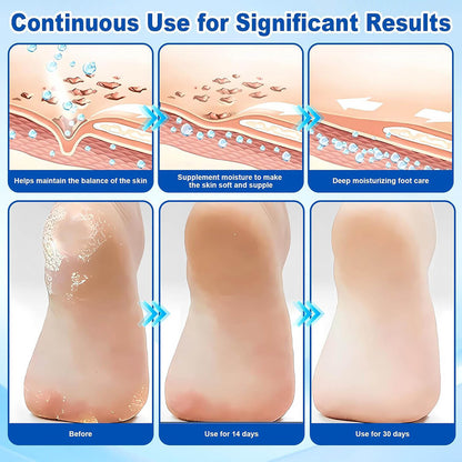 StrideGuard™ Stick