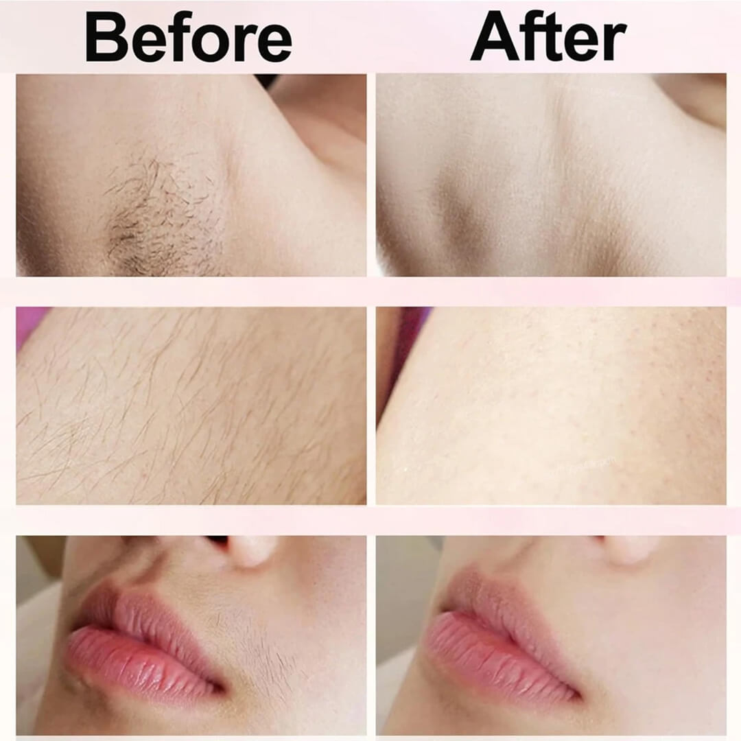 BareNaked™ – Painless Bikini Trimmer & Body Shaver