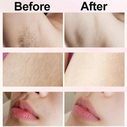 BareNaked™ – Painless Bikini Trimmer & Body Shaver