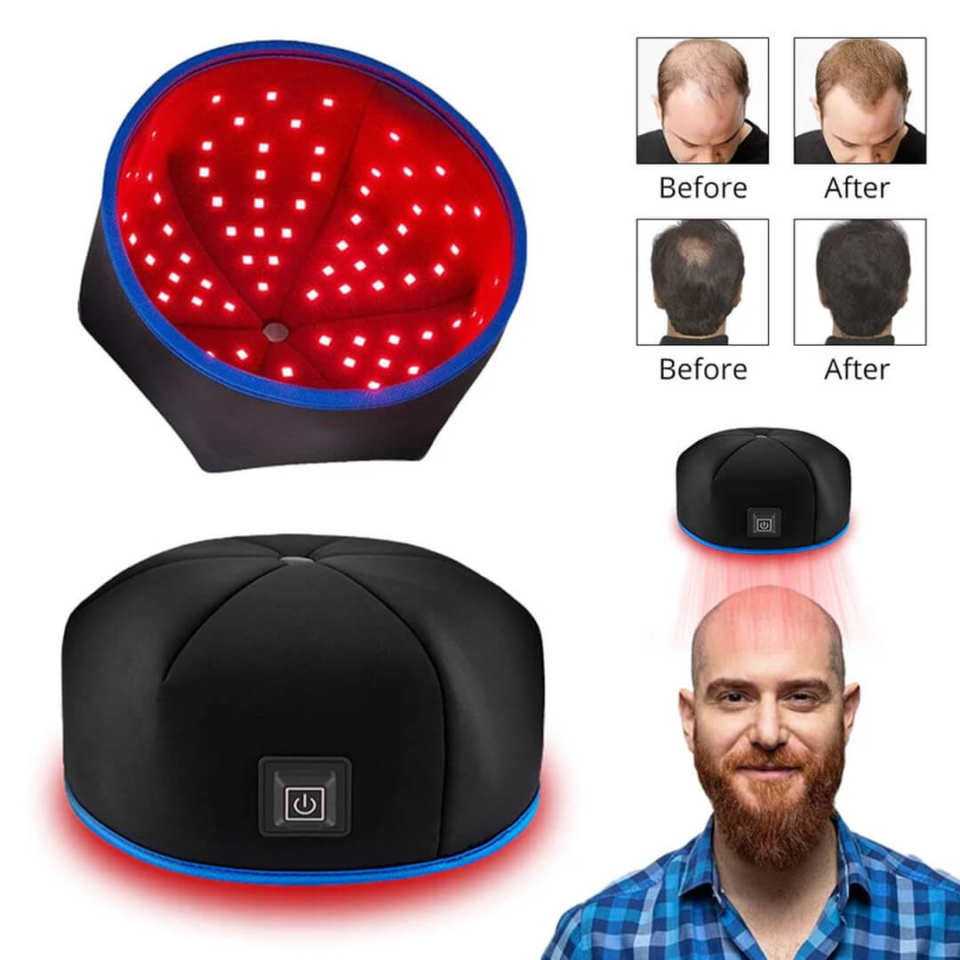 FolliCure™ – Laser Hair Regrowth Cap for Men