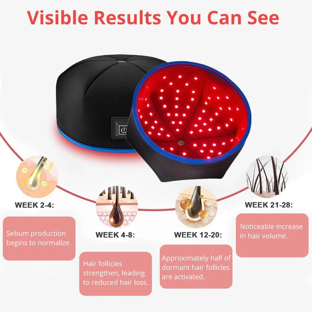 FolliCure™ – Laser Hair Regrowth Cap for Men