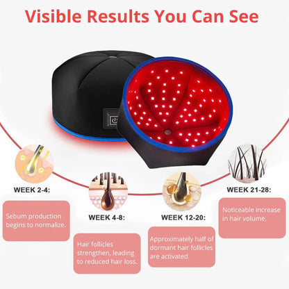 FolliCure™ – Laser Hair Regrowth Cap for Men