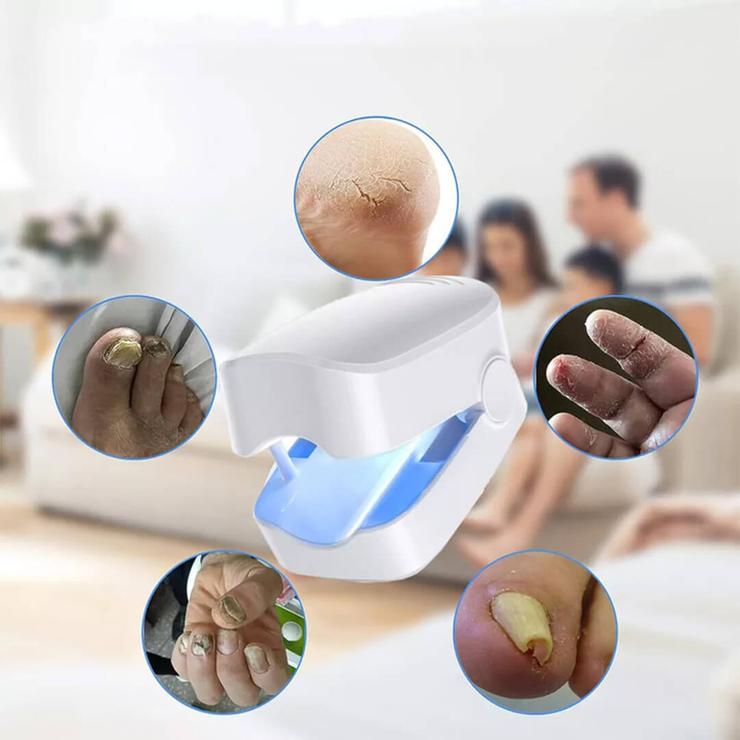 CuraToe™ – Light Therapy for Toenails