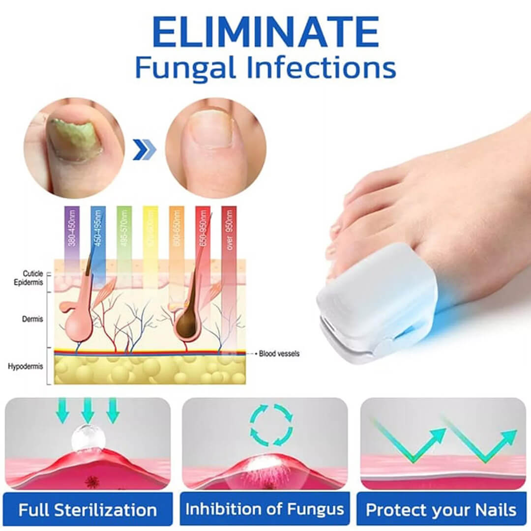 CuraToe™ – Light Therapy for Toenails