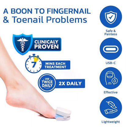 CuraToe™ – Light Therapy for Toenails